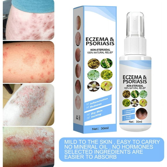 Anti Itch Spray &Antiseptic, Bacteriostatic Spray Body Itch Psoriasis Relief Moisturizing Spray for Psoriasis Treatment for Foot odor & eczema Dry Skin Itch Relief Body Care 1pcs