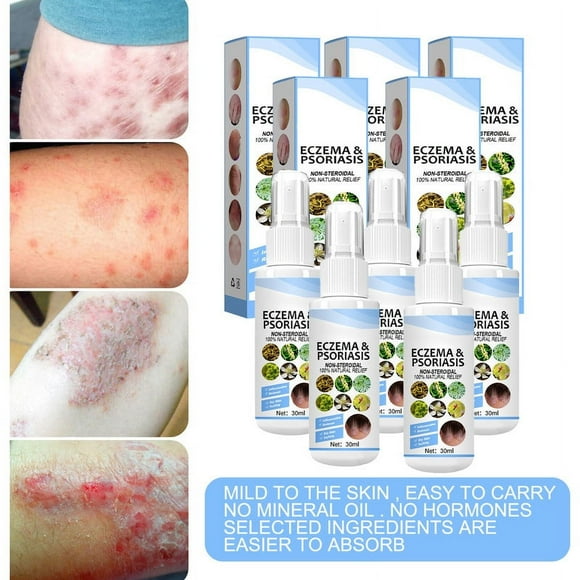 Anti Itch Spray &Antiseptic, Bacteriostatic Spray Body Itch Psoriasis Relief Moisturizing Spray for Psoriasis Treatment for Foot odor & eczema Dry Skin Itch Relief Body Care 4pcs