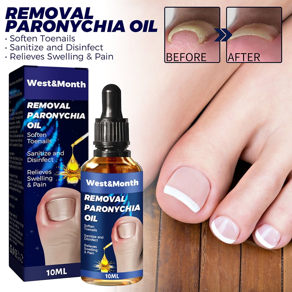Anti Paronychia Relief Oil, MultiPurpose Nail Repair,Toenail Correction Drops,Paronychia