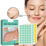 Anti Wart Paste Smooth Skin Desalination Facial Mole Skin Label Anti Wart Paste