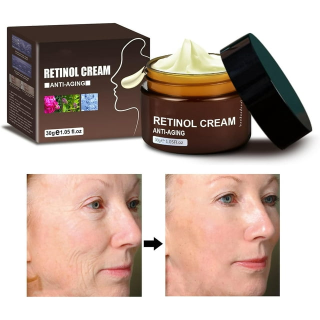 AntiWrinkle Face & Neck Retinol Cream with Hyaluronic Acid Premium