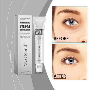 Anti-Wrinkle and Firming Eye Cream with Pro-Retinol for Dark Circles Puffiness Fine Lines Anti-Aging Hydrating Lifting Revitalizing Sensitive Skin Youthful Appearance 0.7oz