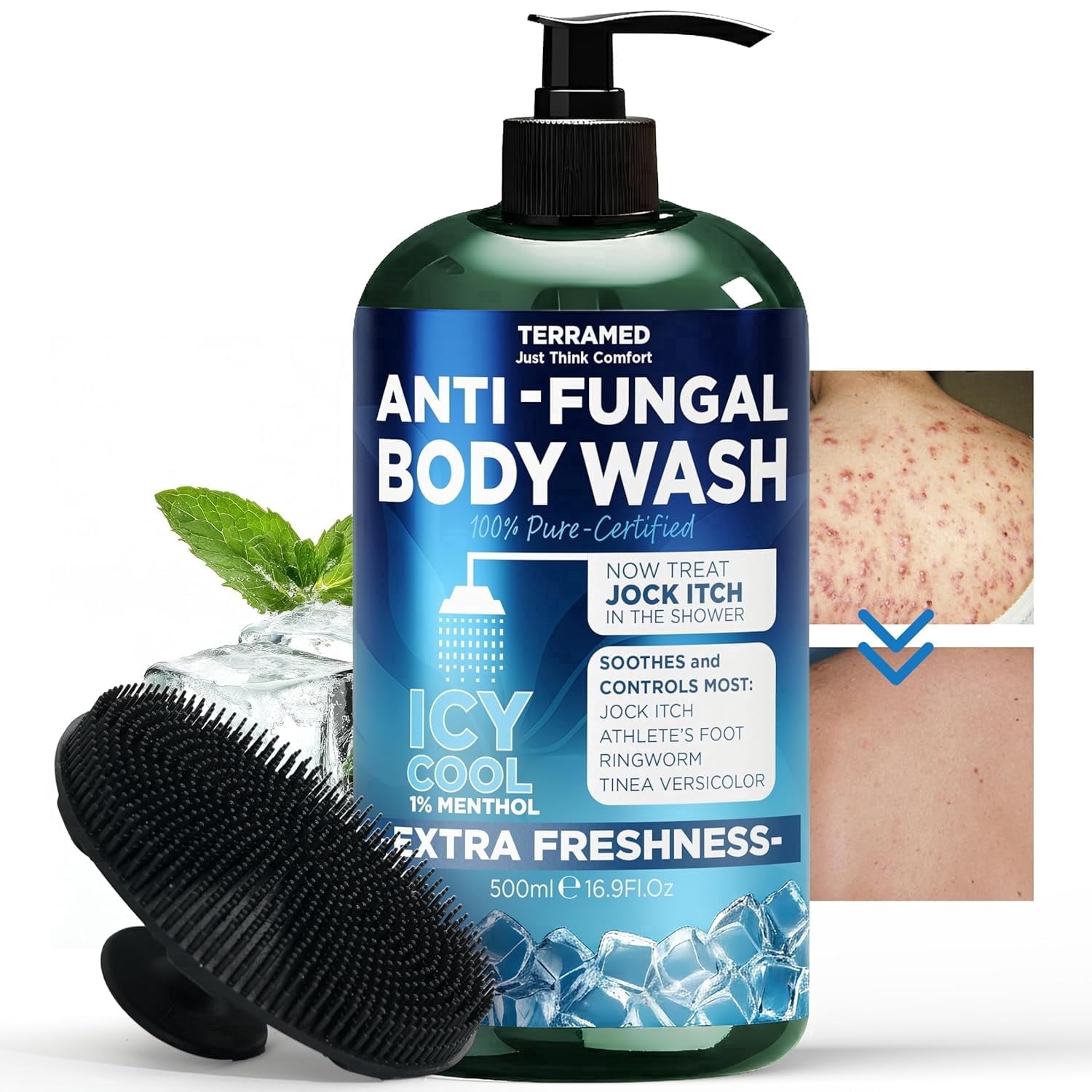 Antifungal Body Wash | Antifungal Soap with 1% Tolnaftate | Medicated Jock Itch Treatment for Ringworm & Athlete’s Foot | Cooling Effect Menthol Body Wash | Includes Scrubber 16.9 Fl oz