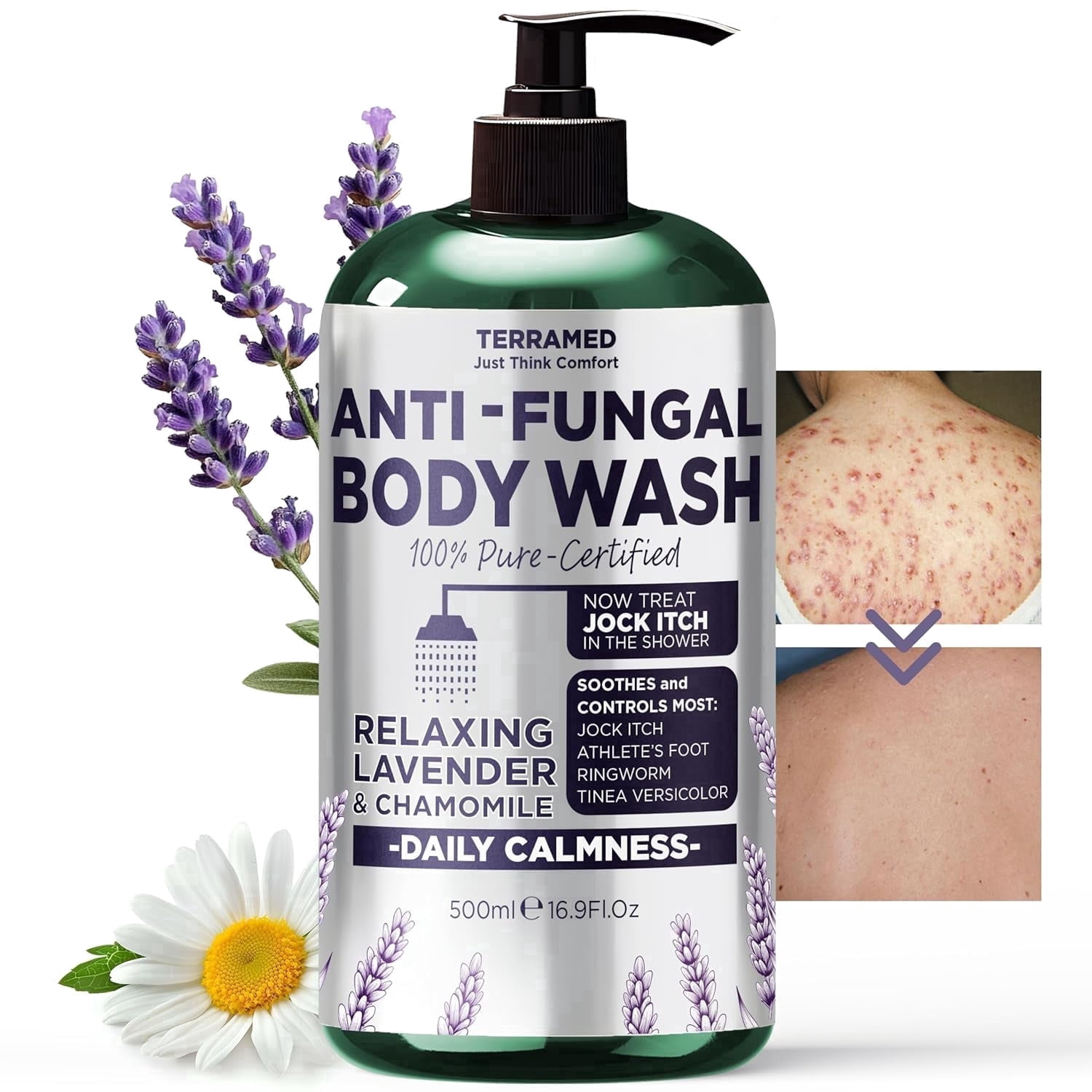 Antifungal Body Wash with Lavender Essential Oil |1% Tolnaftate Chamomile Soap for Ringworm, Jock Itch & Athlete’s Foot | Medicated Itch & Odor Relief Body Wash with Calming Effect | 16.9 oz