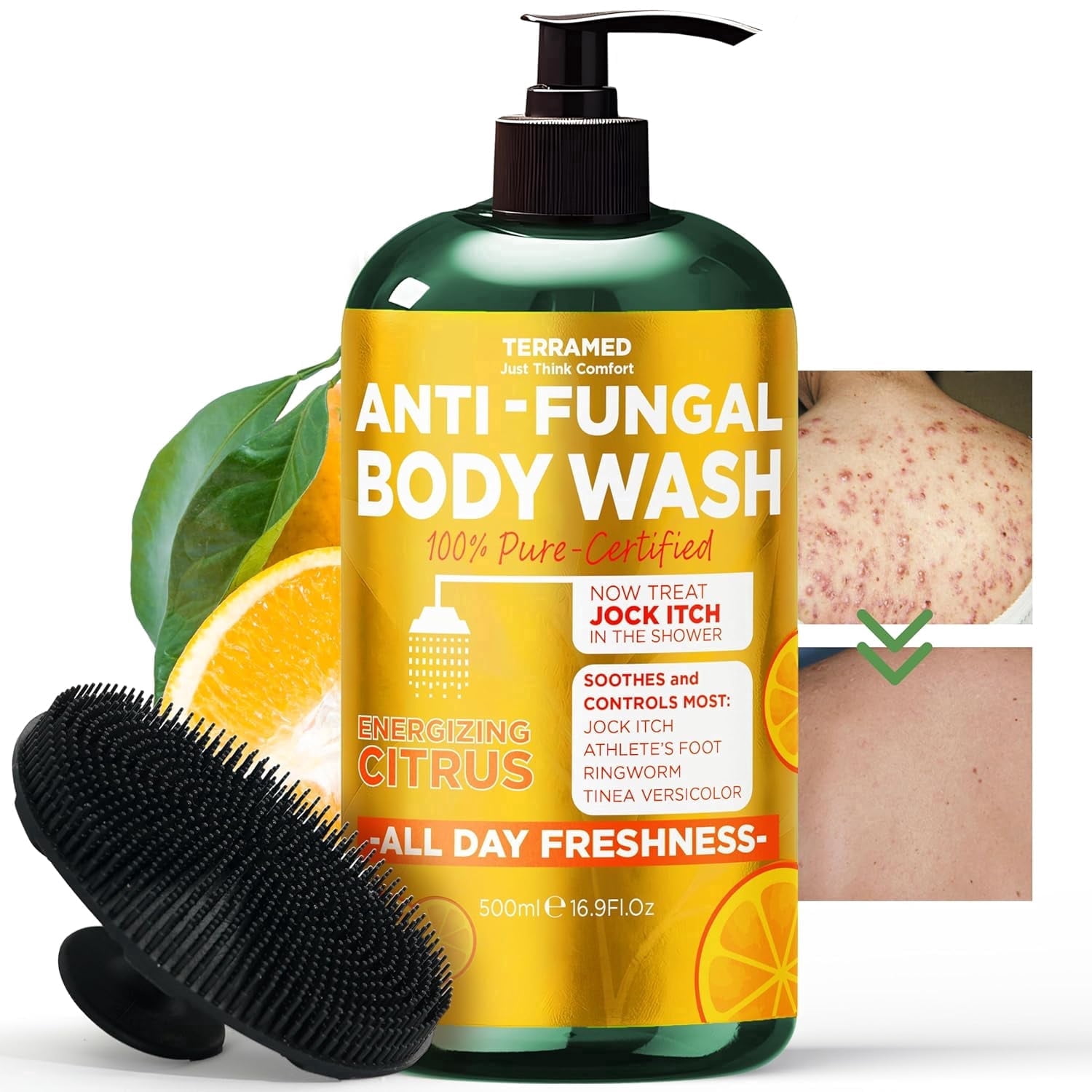 Antifungal Body Wash with Tea Tree Oil & Lemon Oil | 1% Tolnaftate Antifungal Soap Helps Fight Ringworm, Jock Itch & Athlete’s Foot | Medicated Citrus Body Wash Includes Silicone Scrubber | 16.9 oz