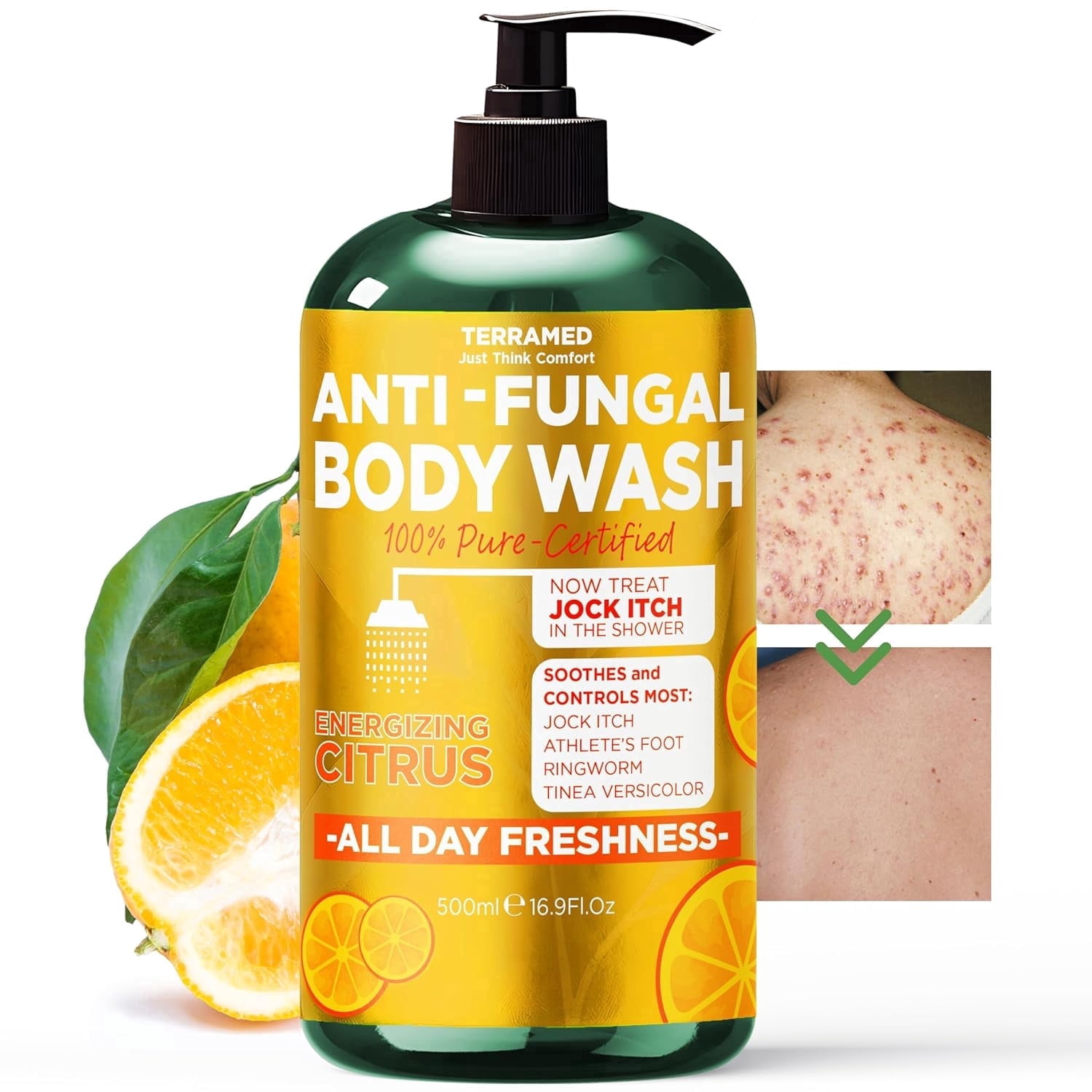 Antifungal Body Wash with Tea Tree Oil & Lemon Oil | 1% Tolnaftate Soap Helps Fight Ringworm, Jock Itch & Athlete’s Foot | Itch & Odor Relief | Medicated Citrus Body Wash for Men & Women | 16.9 oz