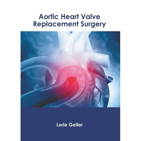 Aortic Heart Valve Replacement Surgery, (Hardcover)