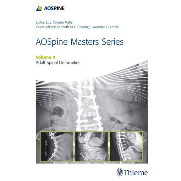 Aospine Masters: Aospine Master Series, Vol. 4: Adult Spinal Deformities (Hardcover)