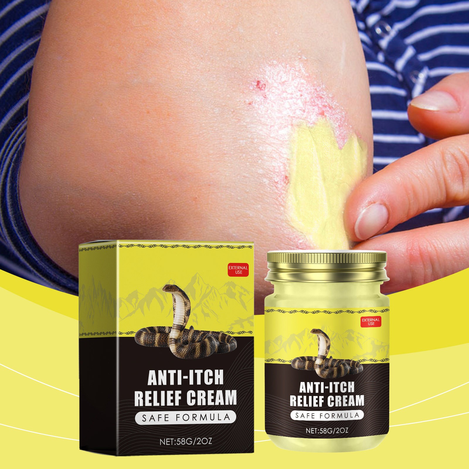 Apepal Antiitch Repairing Cream For Psoriasis,Skin Care Cream, Gentle