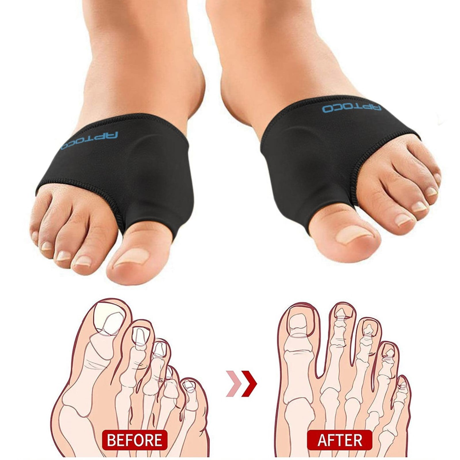 Aptoco Compression Bunion Corrector for Women & Men, Copper Bunion Pads