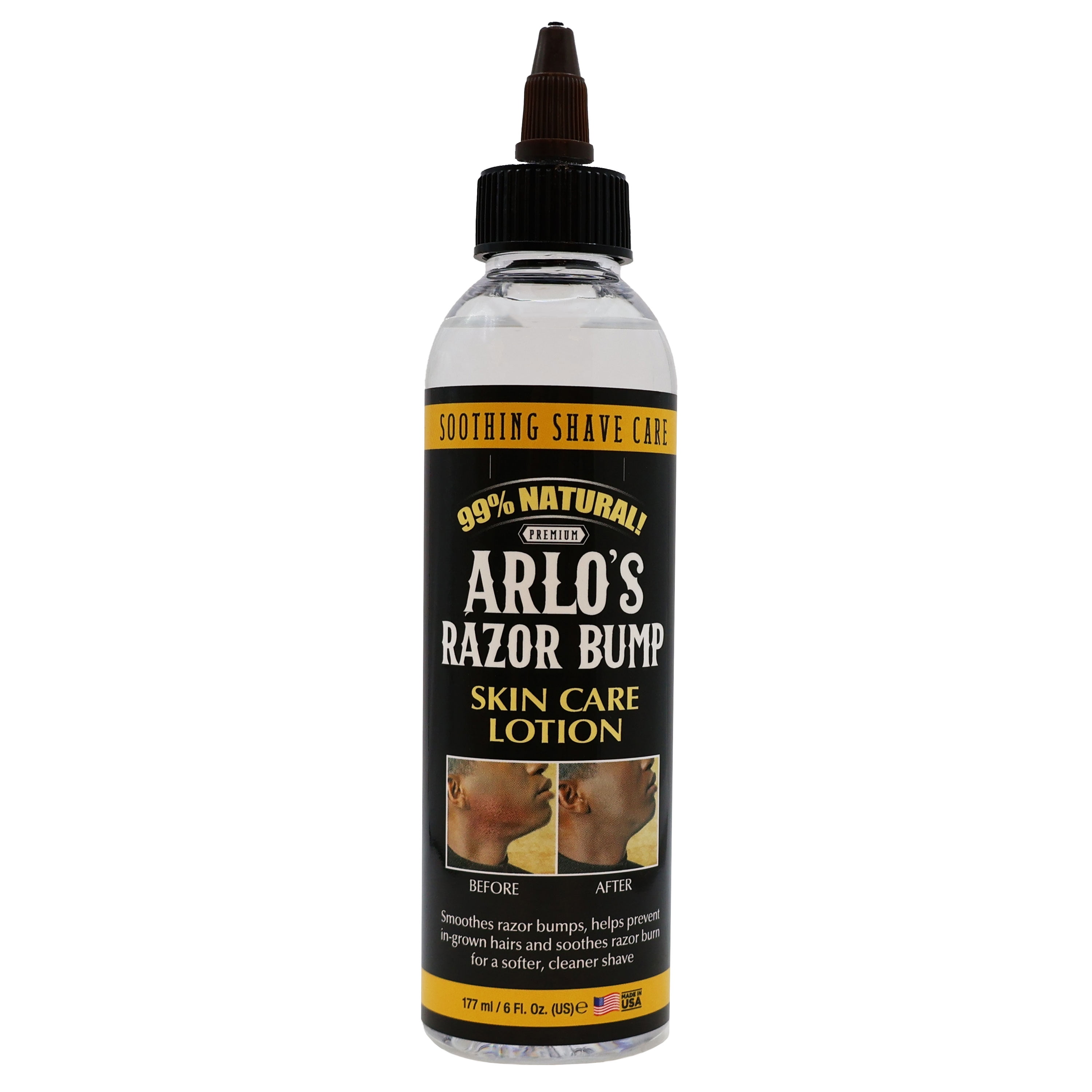 Arlo's Razor Bump Skin Care Lotion 6 Oz., Pack of 2 