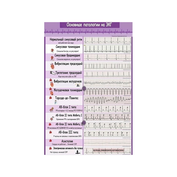 Arrhythmia Recognition E.K.G E.C.G Rhythms Chart Poster Complete Medical Reference Guide for Nursing Students and Healthcare Professionals