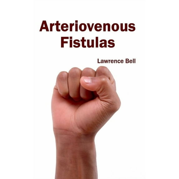 Arteriovenous Fistulas, (Hardcover)