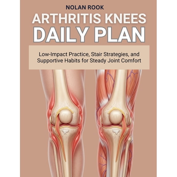 Arthritis Knees Daily Plan: Low-impact practice, stair strategies, and supportive habits for steady joint comfort, (Paperback)