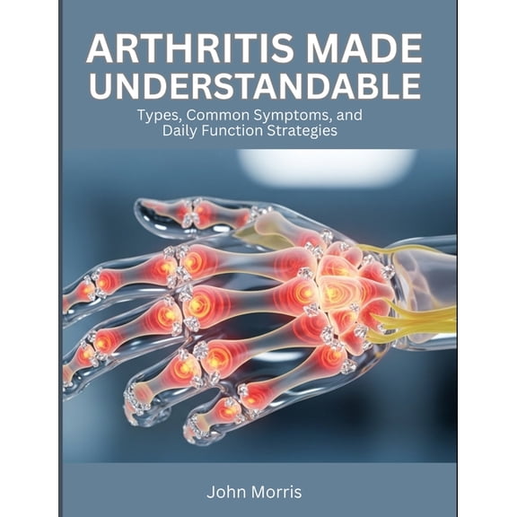 Arthritis Made Understandable: Types, Common Symptoms, and Daily Function Strategies, (Paperback)
