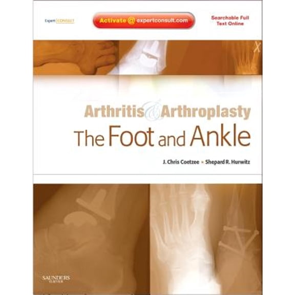 Pre-Owned Arthritis and Arthroplasty: The Foot and Ankle: Expert Consult - Online, Print and DVD (Hardcover) by Christian Coetzee, Shepard R. Hurwitz