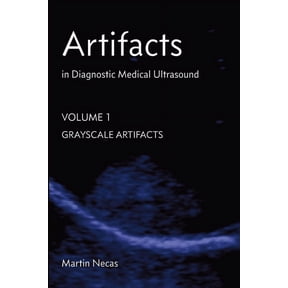 Artifacts in Diagnostic Medical Ultrasound: Grayscale Artifacts, (Paperback)
