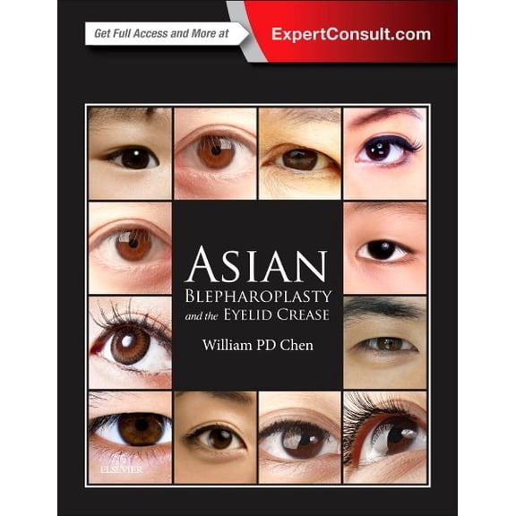 Asian Blepharoplasty and the Eyelid Crease, 3e