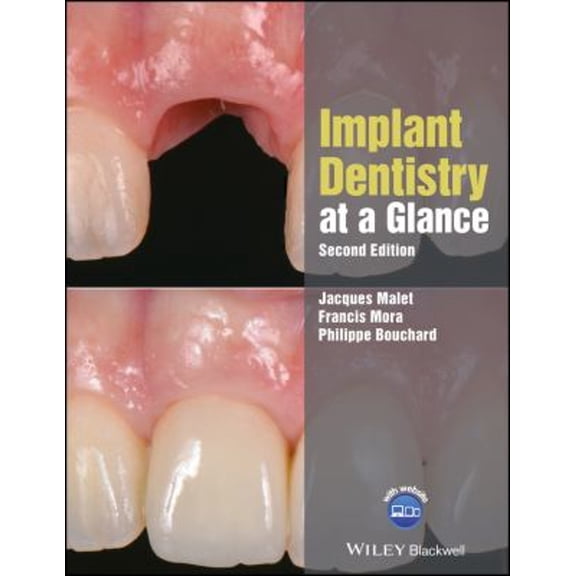 Pre-Owned Implant Dentistry at a Glance (Paperback) 9781119292609