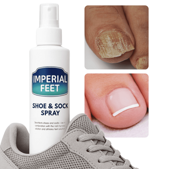 Athletes Foot Shoe Spray for Fungal Nail Treatment | Athletes Foot & Anti Toe Nail Fungus Treatment and Foot Fungus | Ringworm Foot Care Shoe Freshener | 150 ML