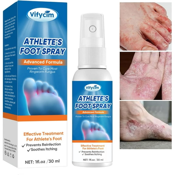 Athletes Foot Treatment Extra Strength - Effective Fungi Treatment Athletes Foot Spray - Itching and Odor Removal