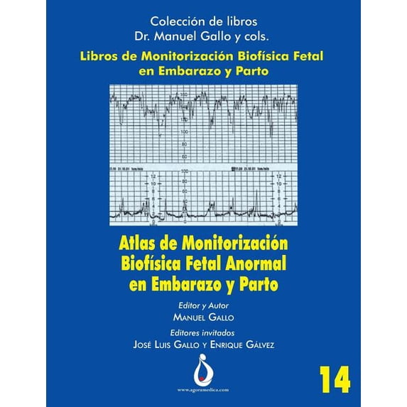 Coleccion de Libros Dr. Manuel Gallo Y Cols: Atlas de Monitorizacion Biofisica Fetal Anormal En El Embarazo Y Parto (Paperback)