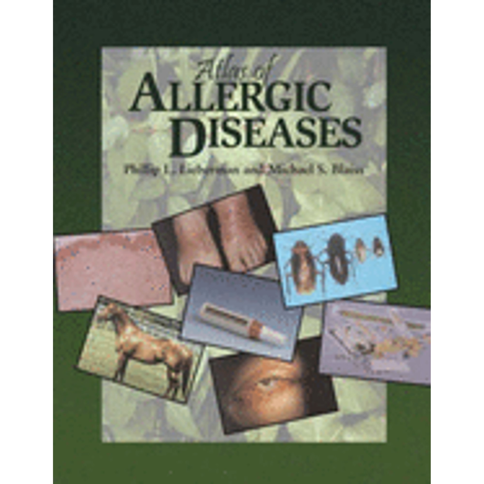 Pre-Owned Atlas of Allergic Diseases (Hardcover 9781573401821) by Phil ...