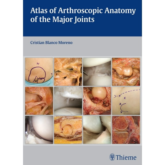Atlas of Arthroscopic Anatomy of the Major Joints, (Hardcover)