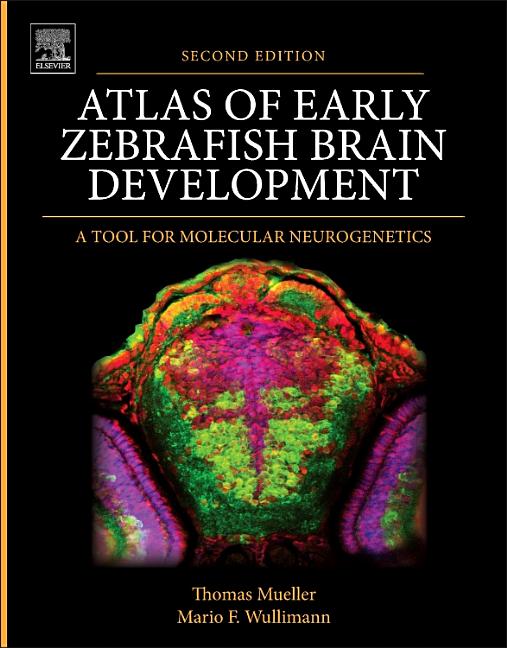 Atlas of Early Zebrafish Brain Development A Tool for Molecular
