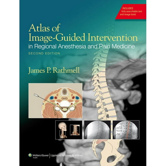 Atlas of Image-Guided Intervention in Regional Anesthesia and Pain Medicine, (Hardcover)