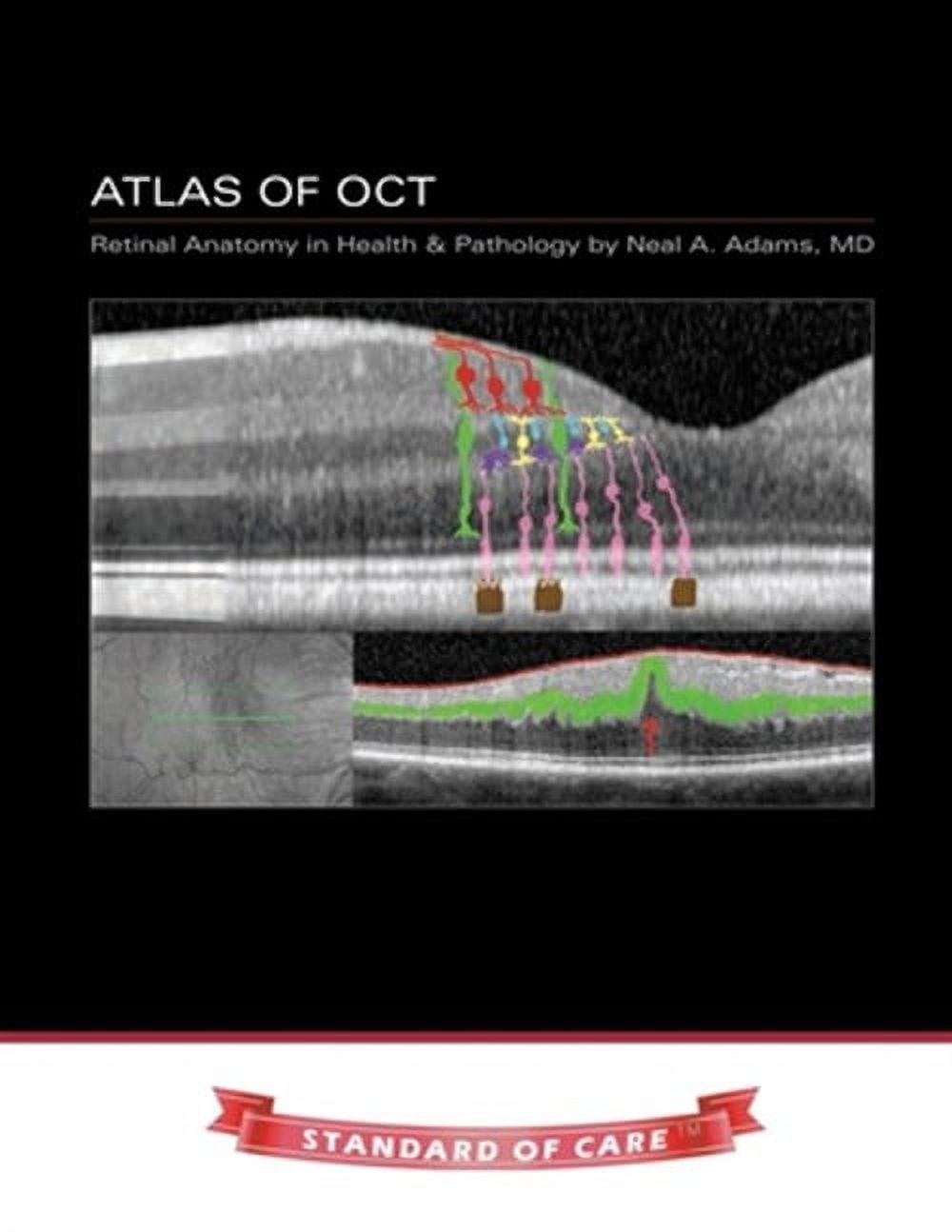 Atlas of OCT: Retinal Anatomy in Health & Pathology - Walmart.com