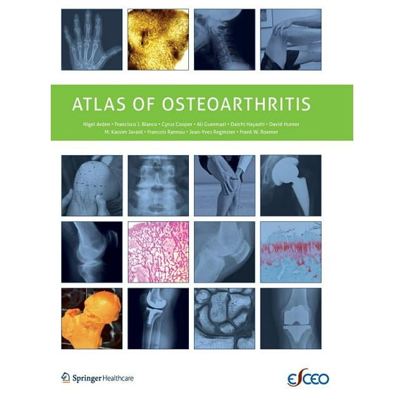 Atlas of Osteoarthritis, (Paperback)