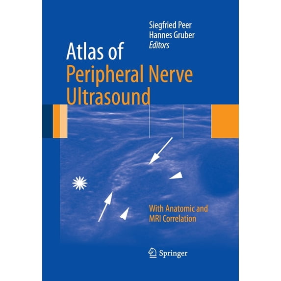 Atlas of Peripheral Nerve Ultrasound: With Anatomic and MRI Correlation, (Paperback)