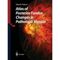 thumbnail image 1 of Atlas of Posterior Fundus Changes in Pathologic Myopia, (Paperback), 1 of 1