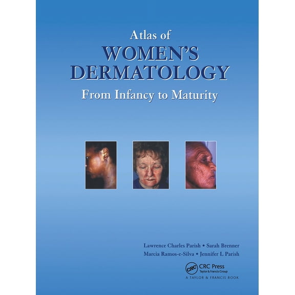 Atlas of Women's Dermatology: From Infancy to Maturity, (Hardcover)