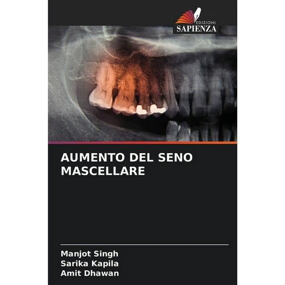 Aumento del Seno Mascellare (Paperback)
