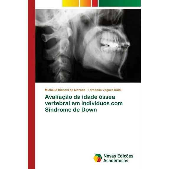 Avaliação da idade óssea vertebral em indivíduos com Síndrome de Down (Paperback)