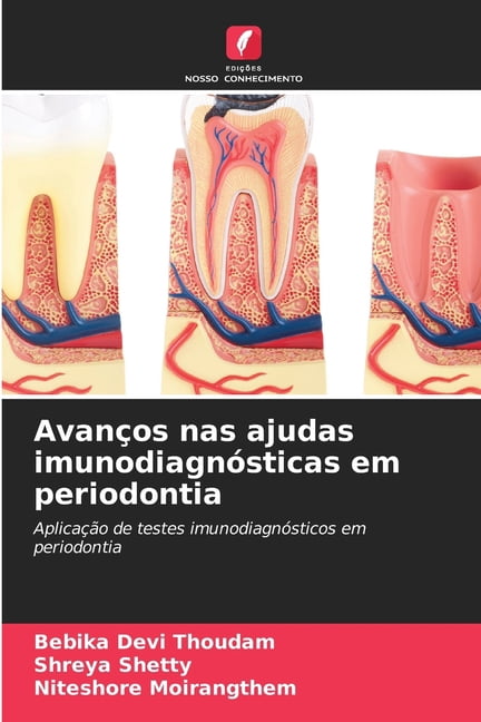 AvanÃ§os nas ajudas imunodiagnÃ³sticas em periodontia, (Paperback)
