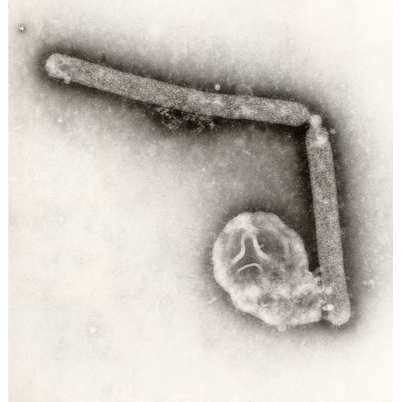 Avian Influenza A Virions. Although This Virus Does Not Typically Infect Humans History (18 x 24)
