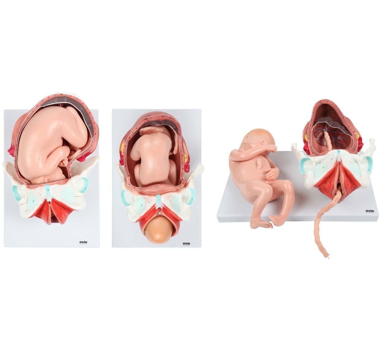 Axis Scientific 3-Stage Childbirth Process Anatomical Model, Numbered Set of 3 Birth Stages, Includes 1st Stage, Crowning of Head, Full Birth, Umbilical Cord, Placenta, Uterus, Manual