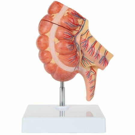 Axis Scientific Caecum and Appendix Anatomy Model | Large Intestine Anatomy Model Enlarged 1.5 Times Life Size | Digestive System Anatomy Model With Appendix