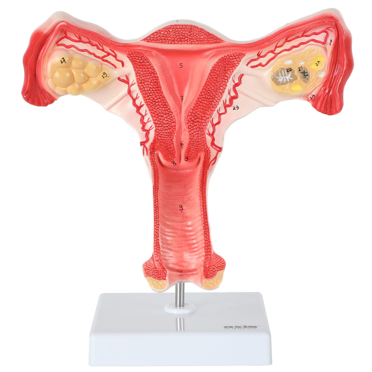 Axis Scientific Female Genital Organs Model