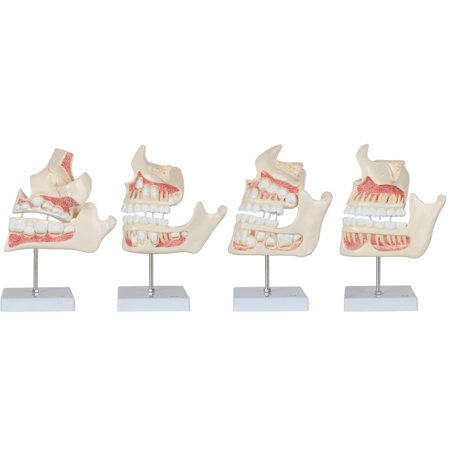 Axis Scientific 4-Stage Development of the Human Teeth - Detailed Enlarged Anatomy Model Set for Dentistry and Study - Demonstrate Adult Tooth Development - Durable and Realistic
