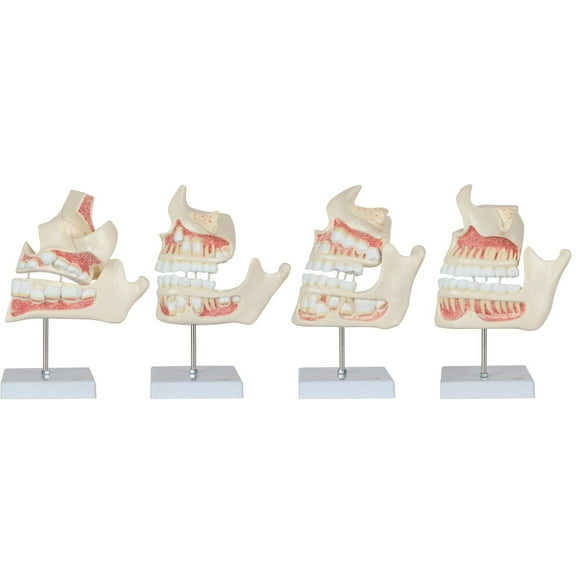 Axis Scientific 4-Stage Development of the Human Teeth - Detailed Enlarged Anatomy Model Set for Dentistry and Study - Demonstrate Adult Tooth Development - Durable and Realistic
