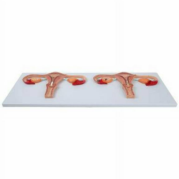 Axis Scientific Human Fertilization Process Model, Features Cross-Section of Uterus, Ovaries, and Fallopian Tubes with Gametes, Includes Detailed Product Manual
