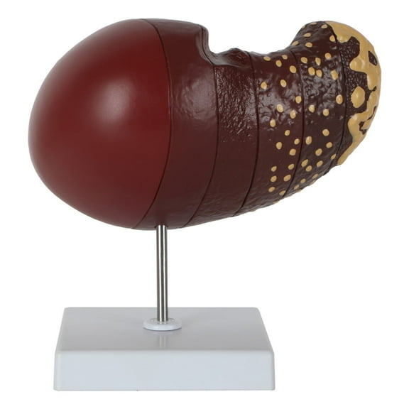 Axis Scientific Life-Size Human Liver with the Progression of Liver Disease - Detailed Life-Size Anatomy Model for Hepatology and Study - Demonstrate 6 Stages of Liver Disease - Durable and Realistic