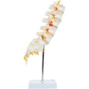 Axis Scientific Lumbar Spine Anatomy Model with Sacrum and Spinal Nerves, Didactic Replica Demonstrates Lumbrosacral Section with Nerves and A Herniated Disc At L4, and Worry-