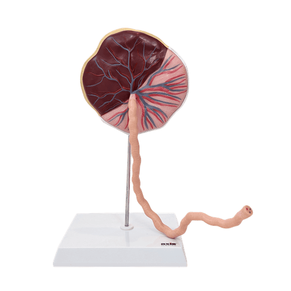 Axis Scientific Placenta Model with Removable Umbilical Cord Anatomical Model - Birthing anatomy model, Placenta Umbilical Cord Anatomical Model,  education for medical school