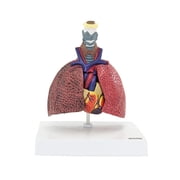 Axis Scientific Respiratory System Pathologies, 5-Parts - Human anatomy system miniature, scientific educational anatomy model, demonstration skill