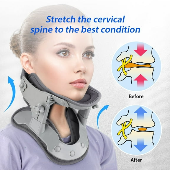BAISEMAIN Heated Neck Traction Device,Portable & Adjustable Cervical Spine Stretcher for Neck Pressure Relief,Cervical Neck Air Traction Collar and Stretcher for Home,Snap-Lock Collar